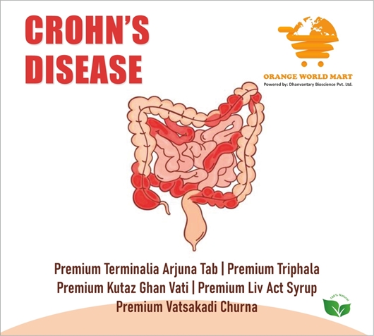 Picture of CROHNS DISEASE KIT
