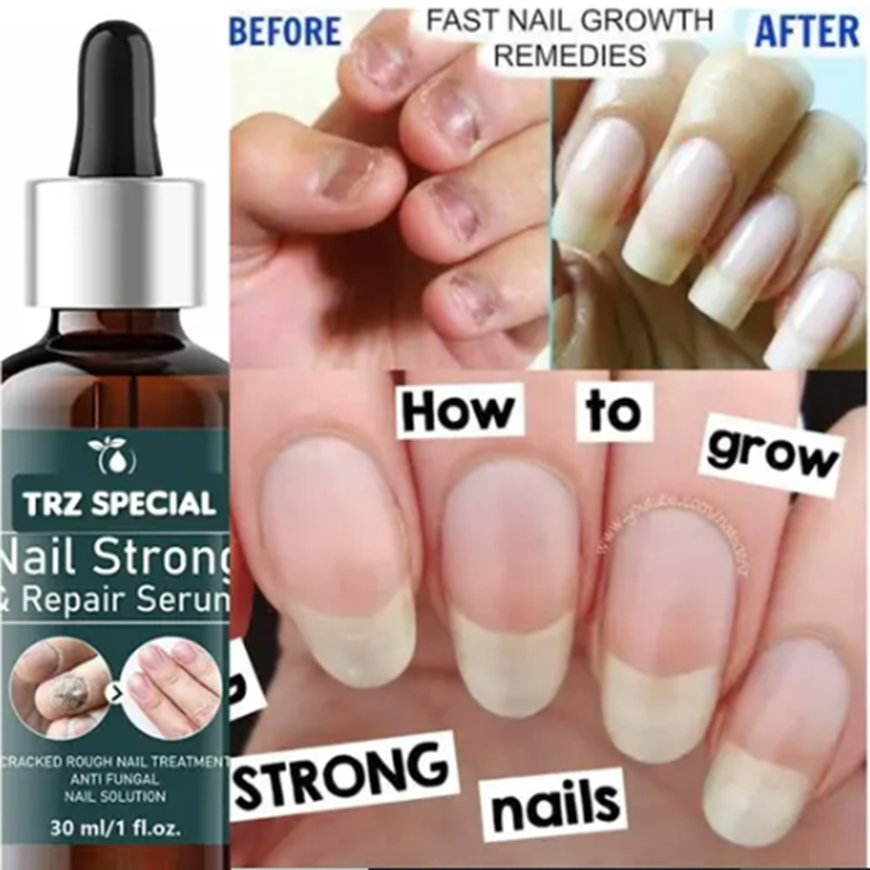 Nail Strong Growth Serum For Shiny And Stronger Nails Growth And Cuticle Care Pack of 1 of 30ML