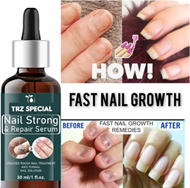 Nail Strong Growth Serum For Shiny And Stronger Nails Growth And Cuticle Care Pack of 1 of 30ML